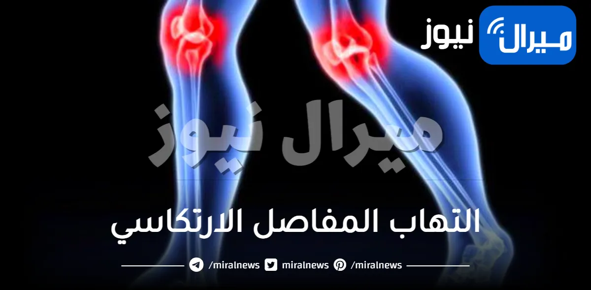 التهاب المفاصل الارتكاسي .. أسباب وطرق علاج التهاب المفاصل الارتكاسي