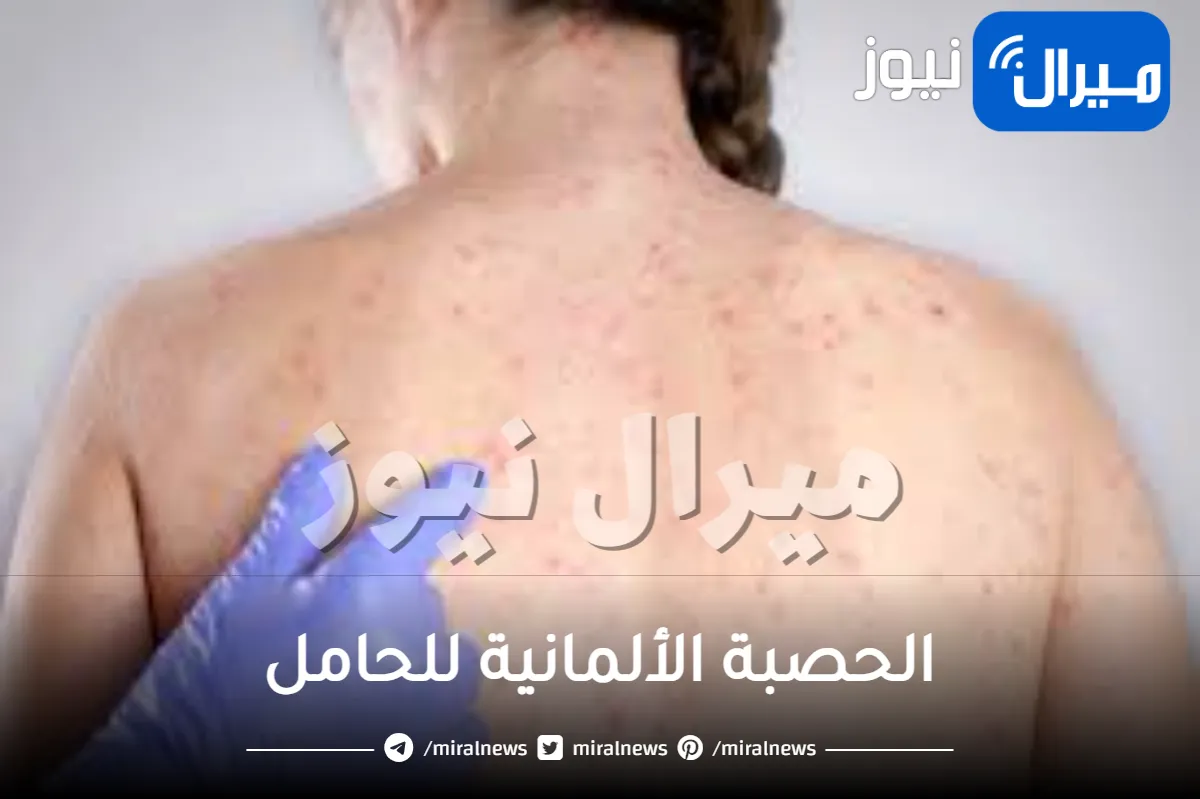 الحصبة الألمانية للحامل .. ما هي الأعراض وكيف تؤثر على الجنين؟