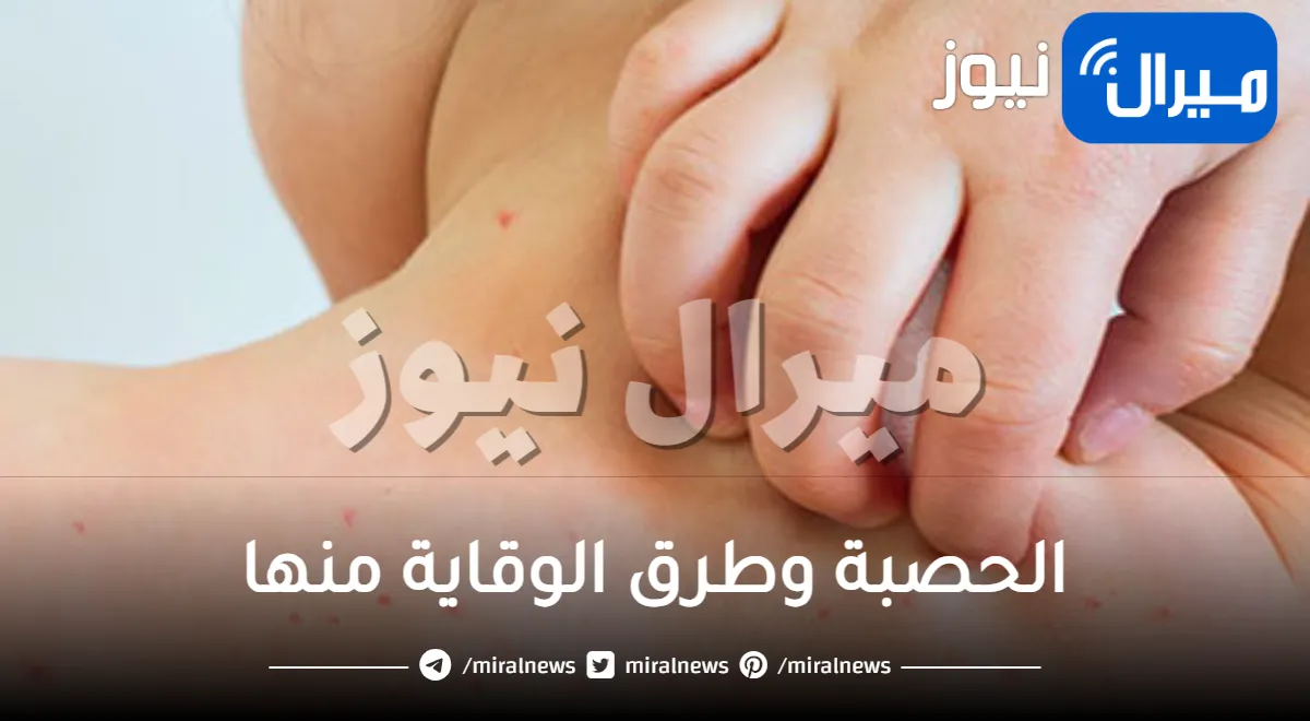 الحصبة وطرق الوقاية منها