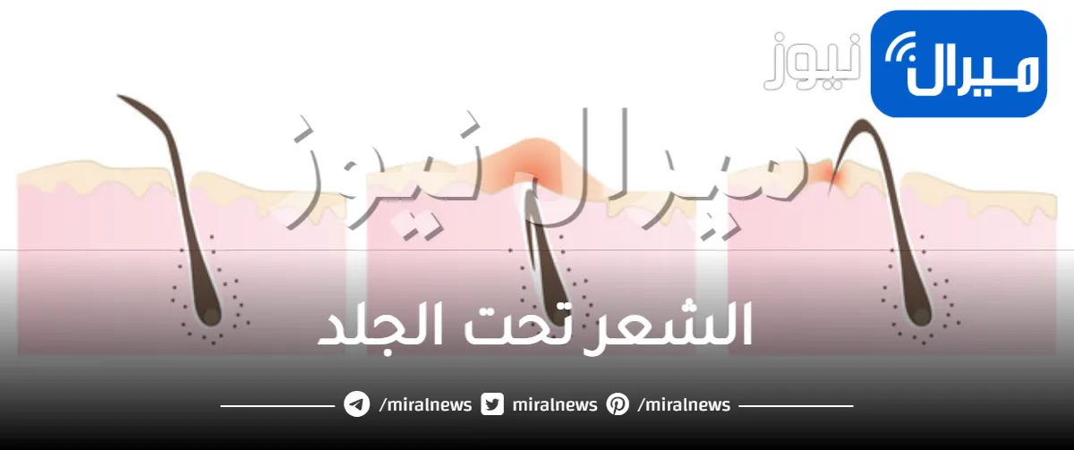 الشعر تحت الجلد.. 5 طرق لعلاجه