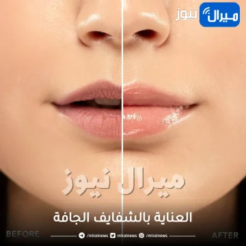 طرق العناية بالشفايف الجافة