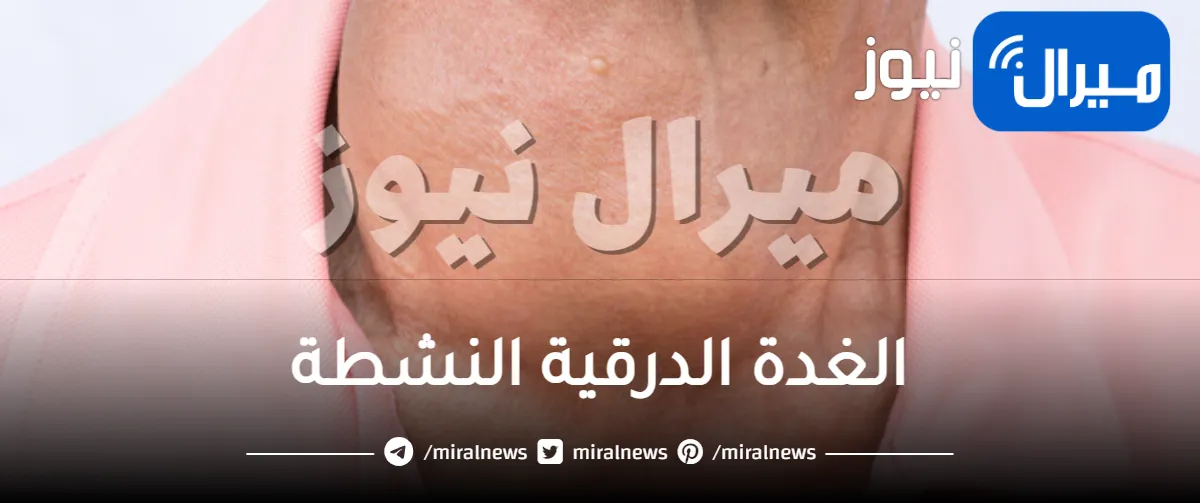 الغدة الدرقية النشطة .. أعراضها وطرق علاجها