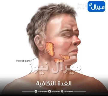 الغدة النكافية ” أعراضها وطرق علاجها”