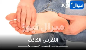 كل ما تحتاج معرفته عن النقرس الكاذب