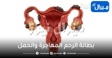 بطانة الرحم المهاجرة والحمل .. وأسرار ستعرفينها لأول مرة