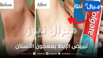 تبييض الإبط بمعجون الأسنان والوصفات المنزلية