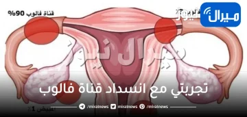 تجربتي مع انسداد قناة فالوب