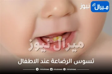 أسباب و علاج تسوس الرضاعة عند الاطفال