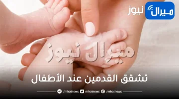 تشقق القدمين عند الأطفال .. الوراثة وزيادة الوزن ضمن الاسباب