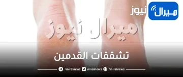 وصفات مذهلة لعلاج تشققات القدمين