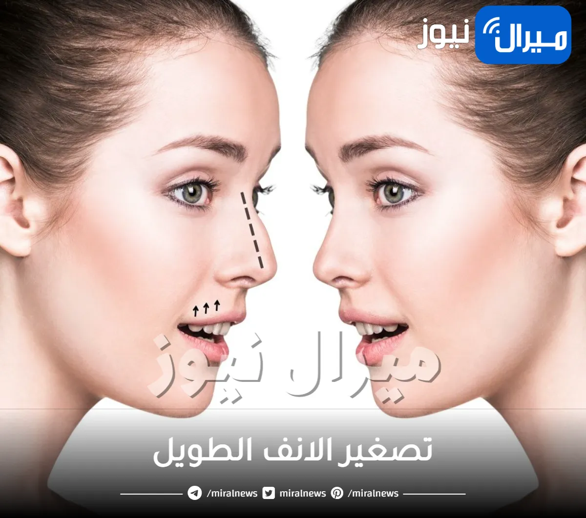 تصغير الانف الطويل .. تعرفي على أشهر الوصفات