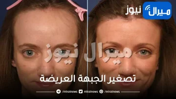6 حيل لتصغير الجبهة العريضة بدون جراحة