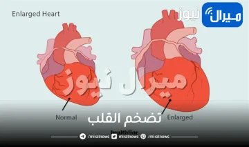 ما هو تضخم القلب .. أعراضه وأشهر أسبابه