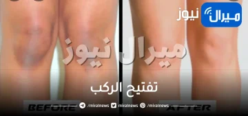 تفتيح الركب بيكربونات الصوديوم