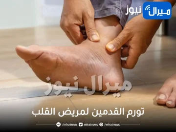 كل ما يخص تورم القدمين لمريض القلب