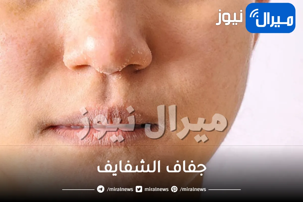جفاف الشفايف كل ما تريدين معرفته عن علاجه واسبابه
