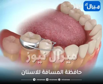 فائدة حافظة المسافة للاسنان بعد الخلع
