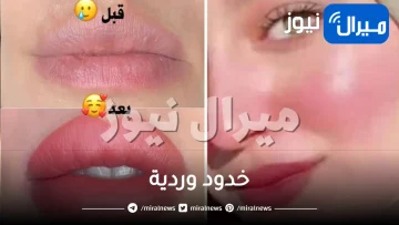 6 طرق طبيعية للحصول على خدود وردية