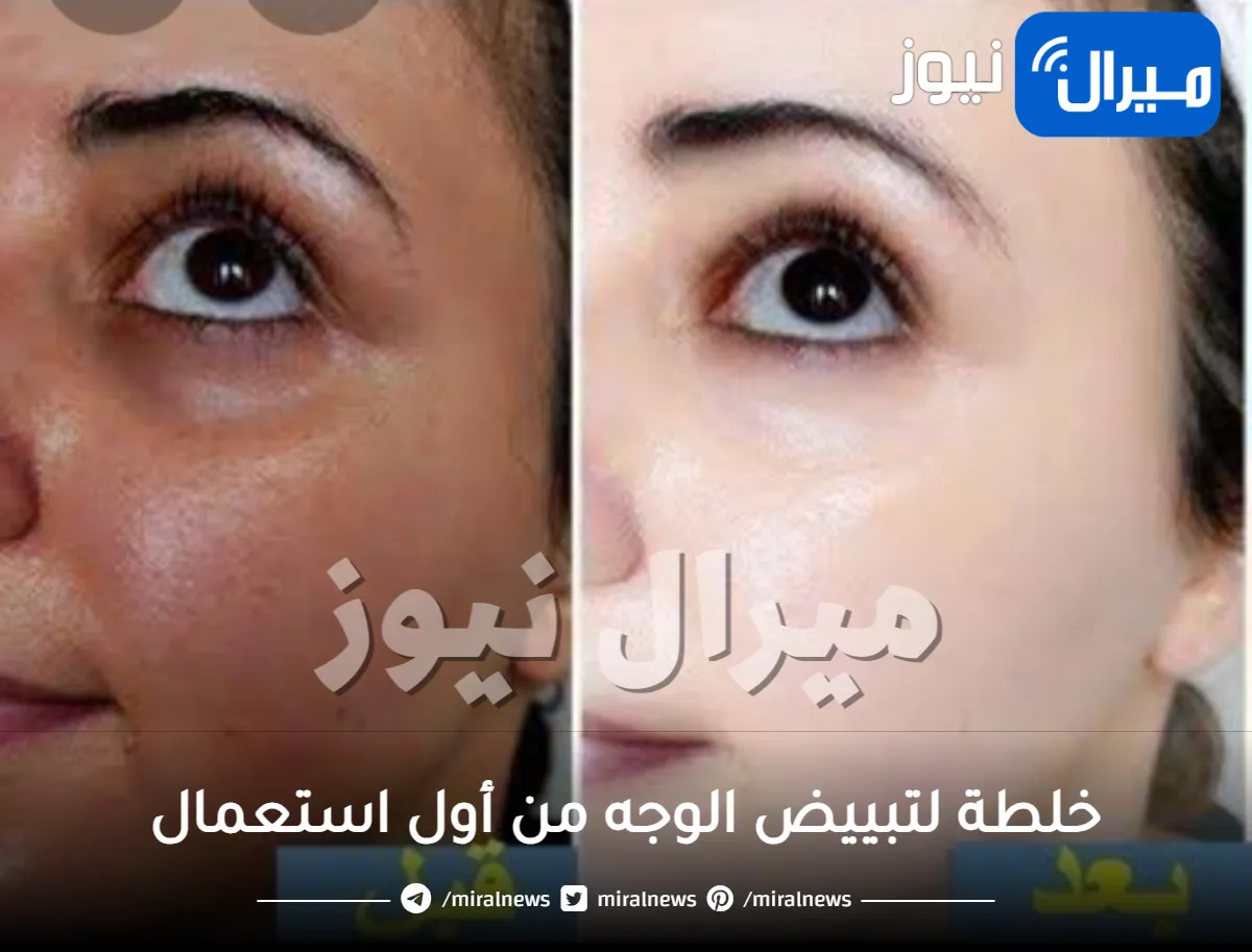 خلطة لتبييض الوجه من أول استعمال .. أفضل 9 خلطات مضمونة