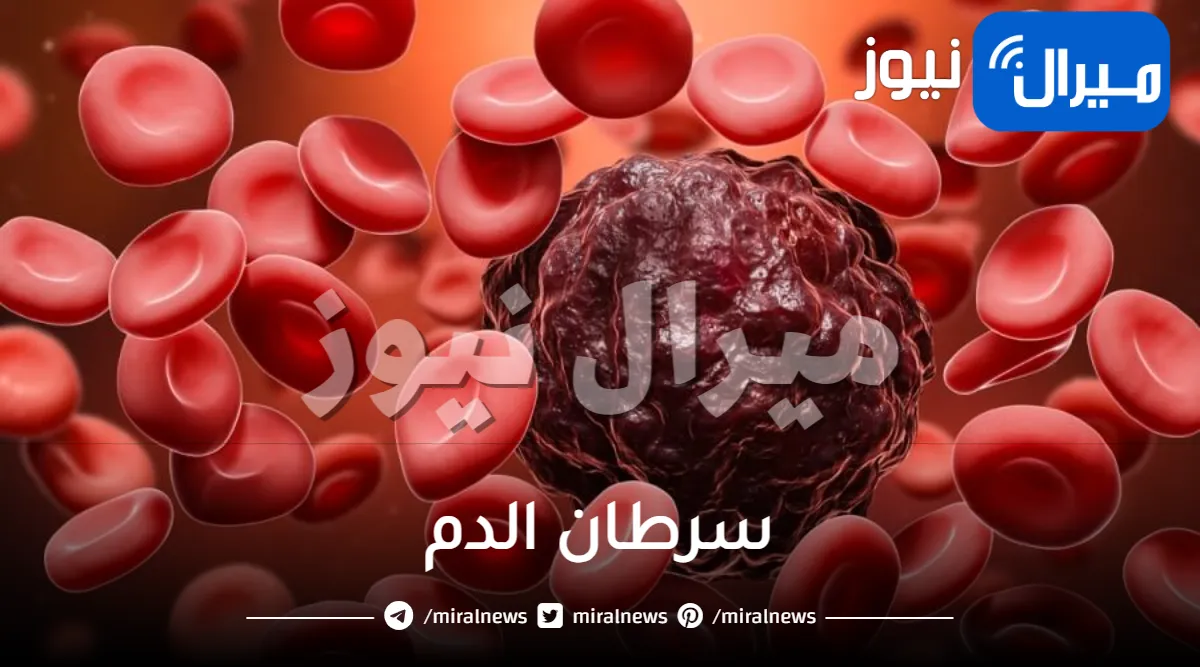 أعراض وعلاج مرض سرطان الدم