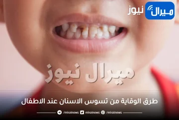طرق الوقاية من تسوس الاسنان عند الاطفال