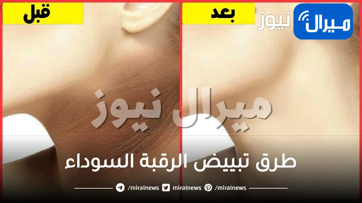 طرق تبييض الرقبة السوداء