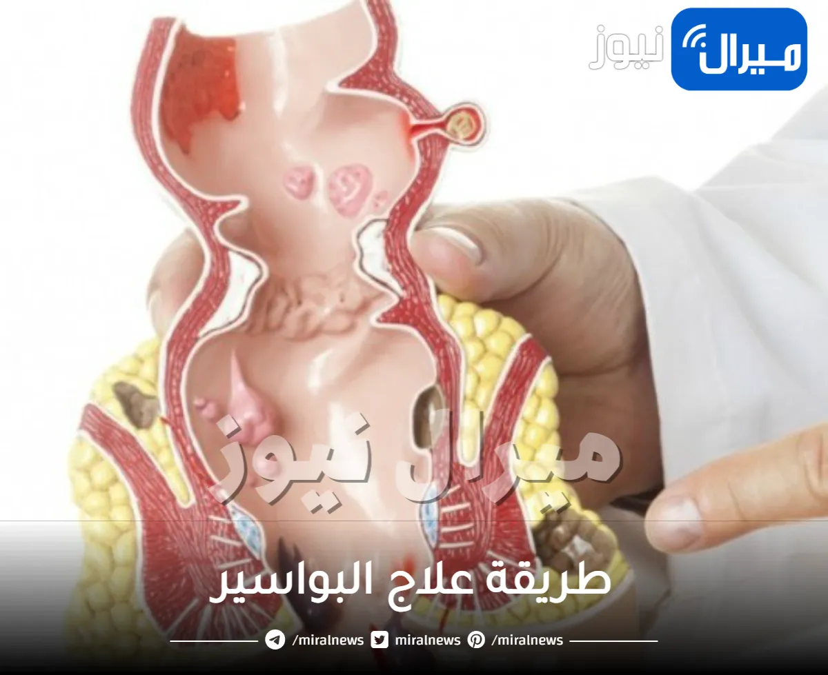 بالطرق المنزلية.. تعرف علي طريقة علاج البواسير