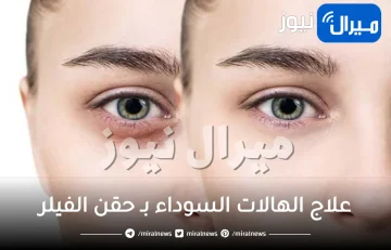 تعرفي على علاج الهالات السوداء بـ حقن الفيلر