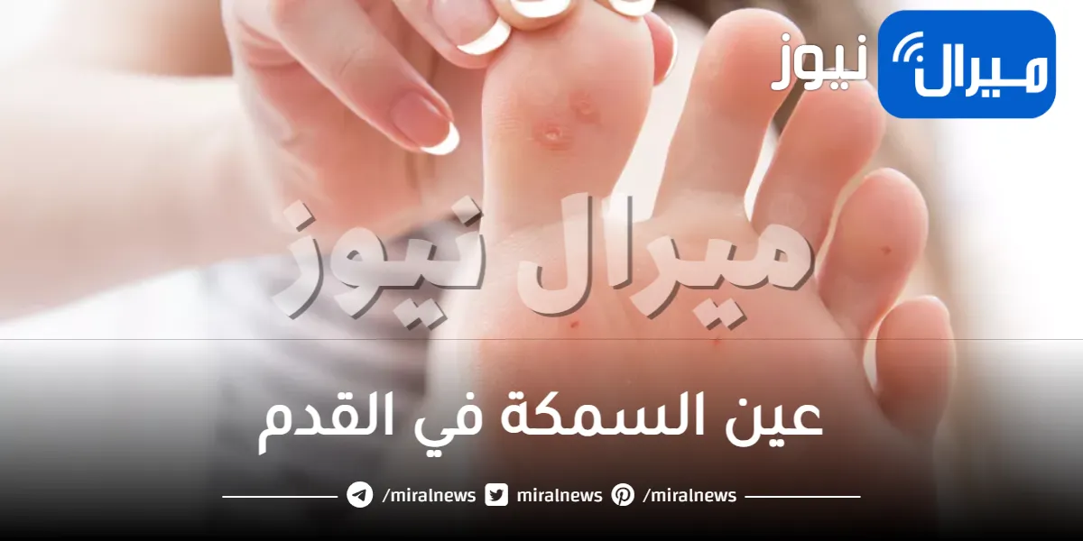 كل ما يخص عين السمكة في القدم