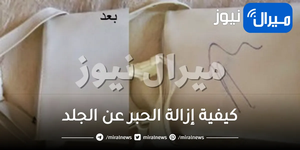 كيفية إزالة الحبر عن الجلد