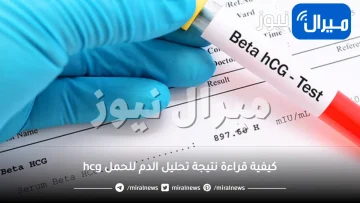كيفية قراءة نتيجة تحليل الدم للحمل hcg