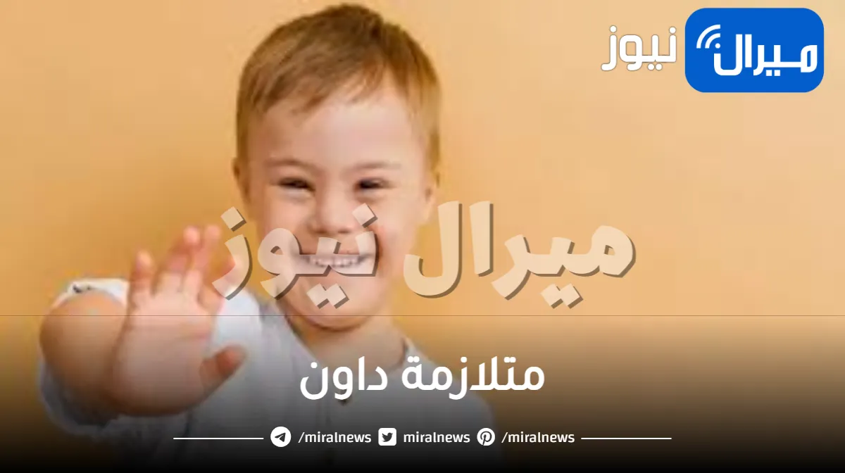 كل ما تريد معرفته عن متلازمة داون