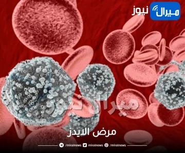 المعلومات الكاملة عن مرض الايدز.. كل ما تريدين معرفته