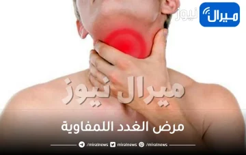 ما هو مرض الغدد اللمفاوية وأسبابه وأعراضه