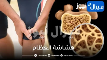 7 أطعمة تحميك من التعرض لـ هشاشة العظام