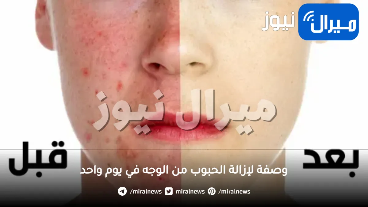 وصفة لإزالة الحبوب من الوجه في يوم واحد