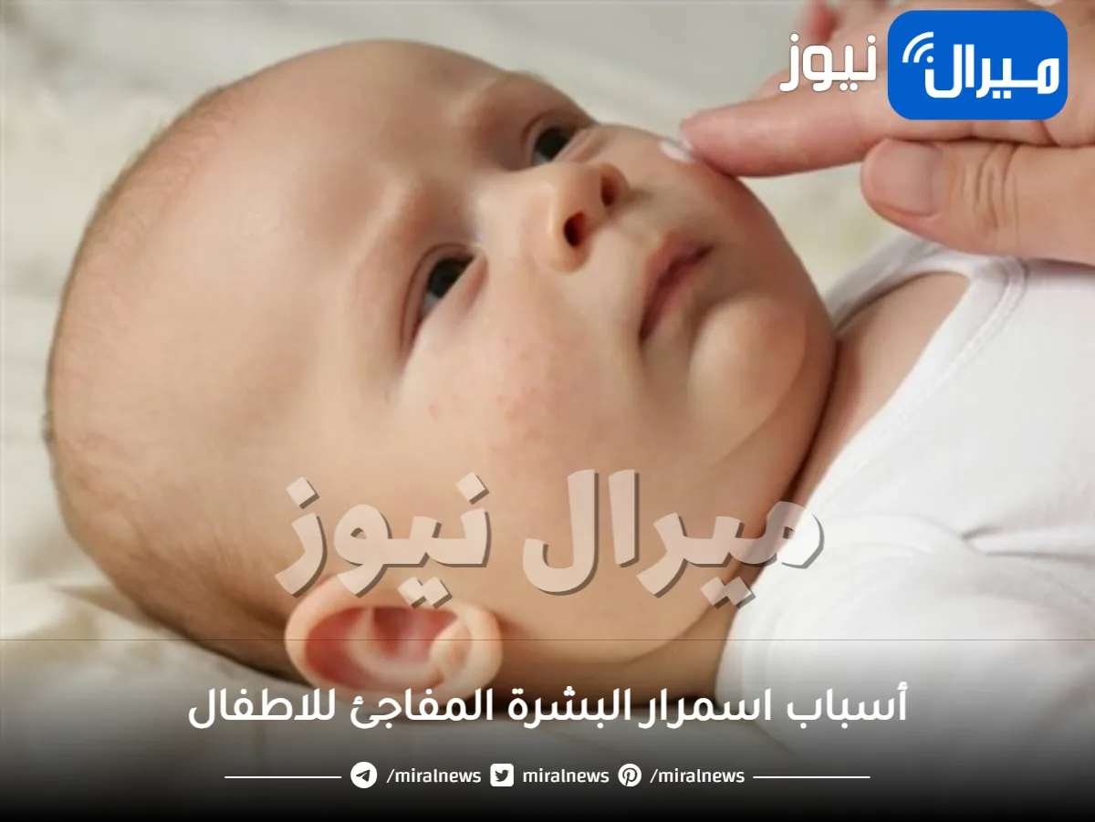 أسباب اسمرار البشرة المفاجئ للاطفال