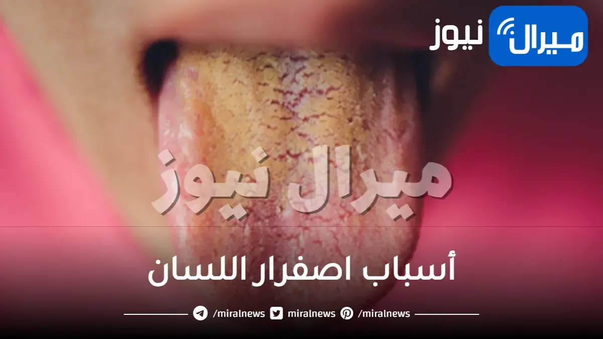 أسباب اصفرار اللسان وطرق علاجه