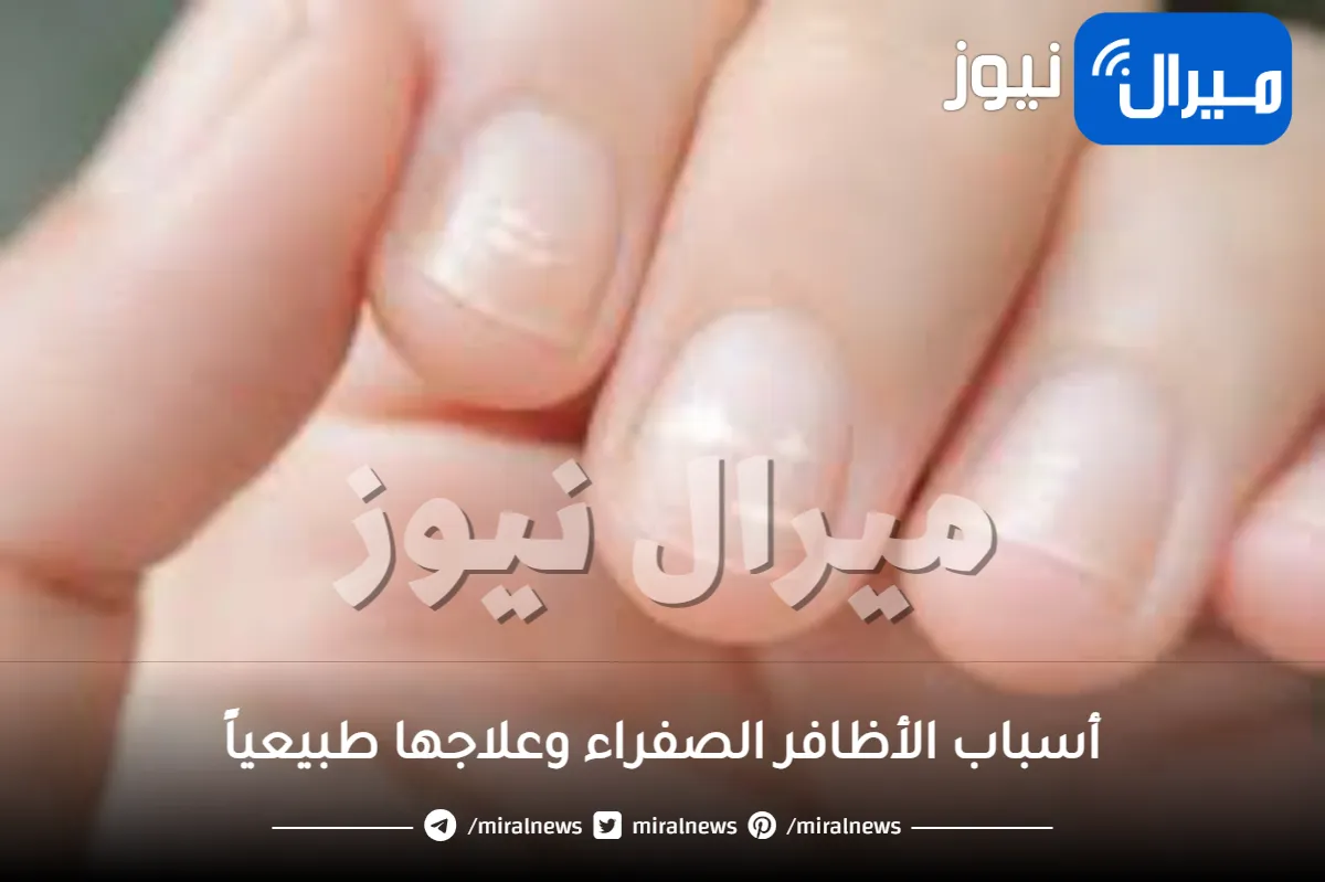 أسباب الأظافر الصفراء وعلاجها طبيعياً