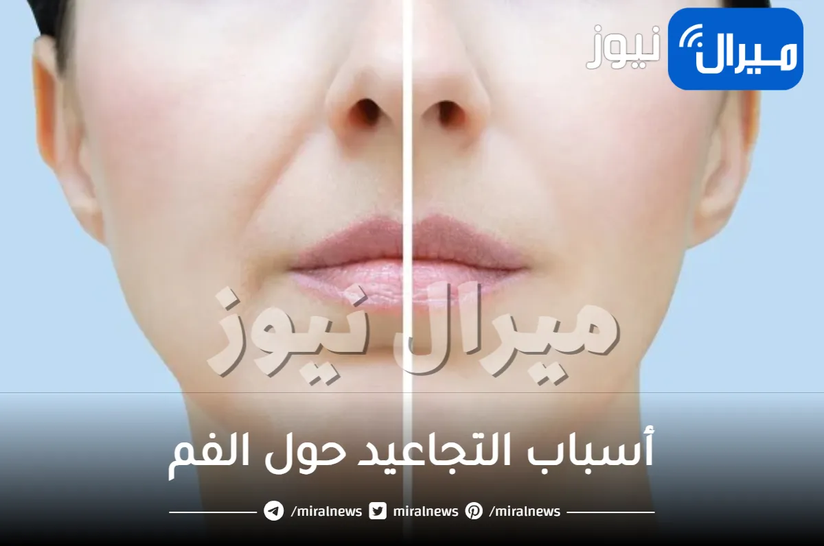 أسباب التجاعيد حول الفم وطرق تجنبها