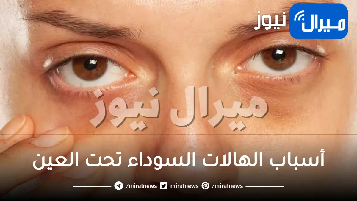 أسباب الهالات السوداء تحت العين المفاجئ وطرق طبيعية لعلاجه