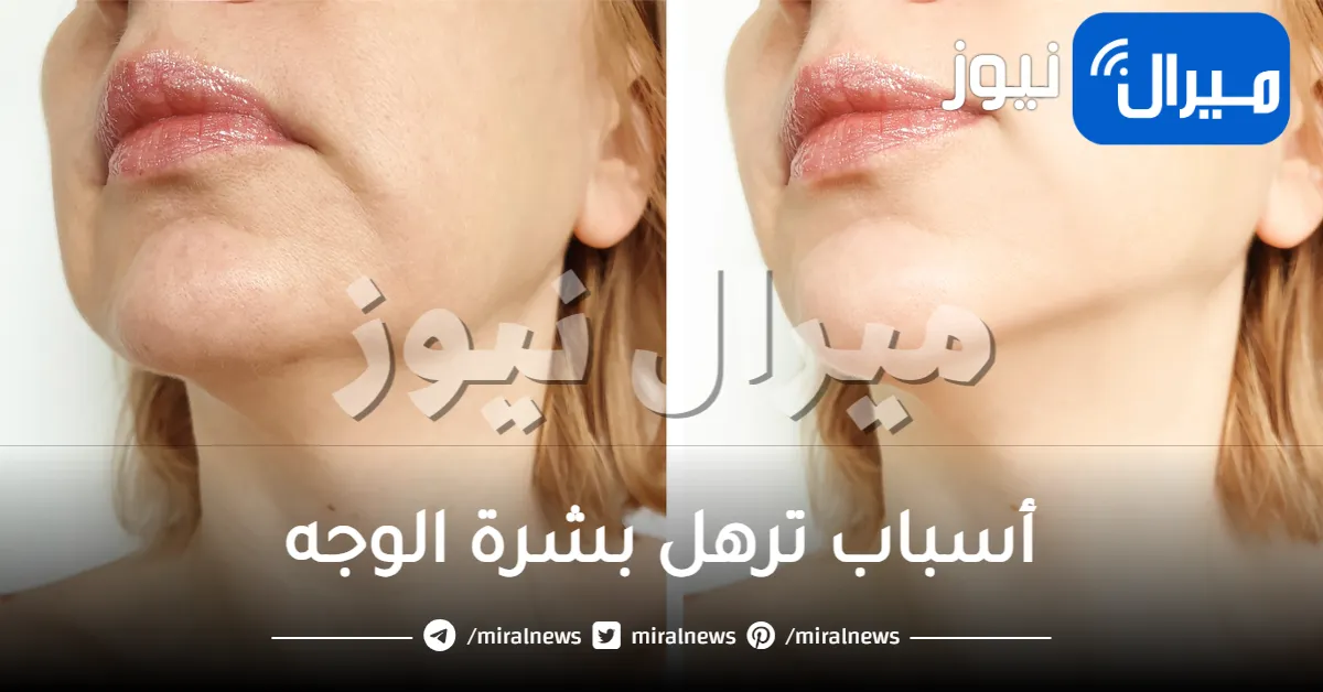 أسباب ترهل بشرة الوجه