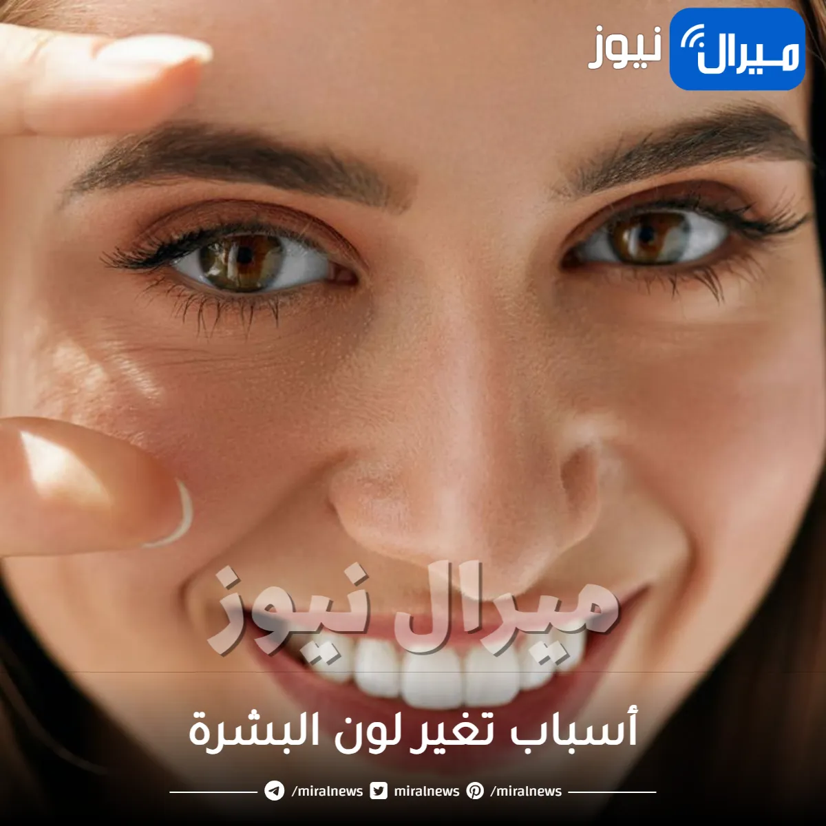 أسباب تغير لون البشرة