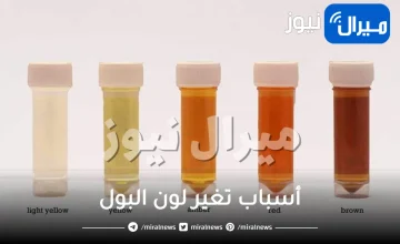 أسباب تغير لون البول وهل هو خطير وأي لون يستدعي التدخل الطبي ؟!!