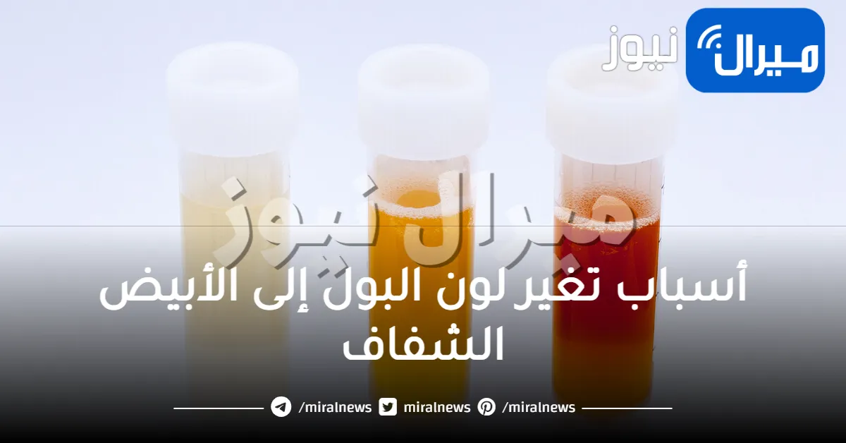 أسباب تغير لون البول إلى الأبيض الشفاف مثل الحليب للأطفال