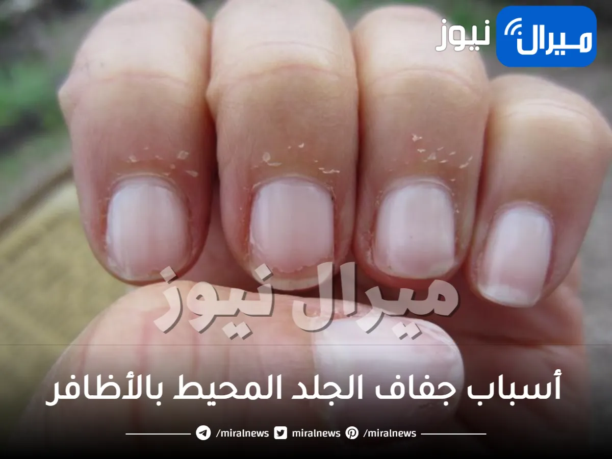 أسباب جفاف الجلد المحيط بالأظافر و7 حلول له