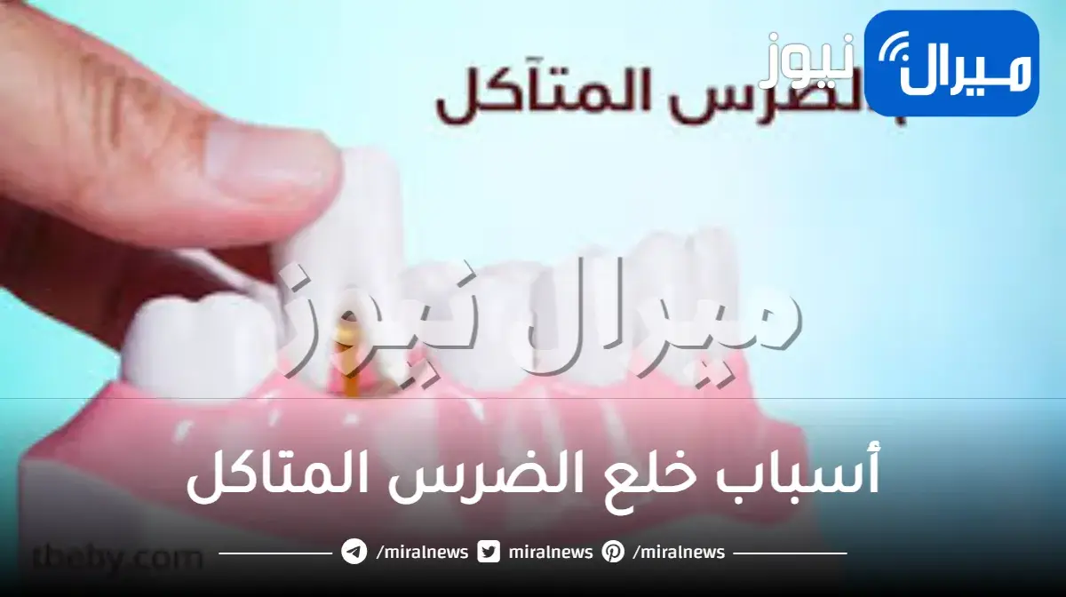 ما هي أسباب خلع الضرس المتاكل وأنواعه