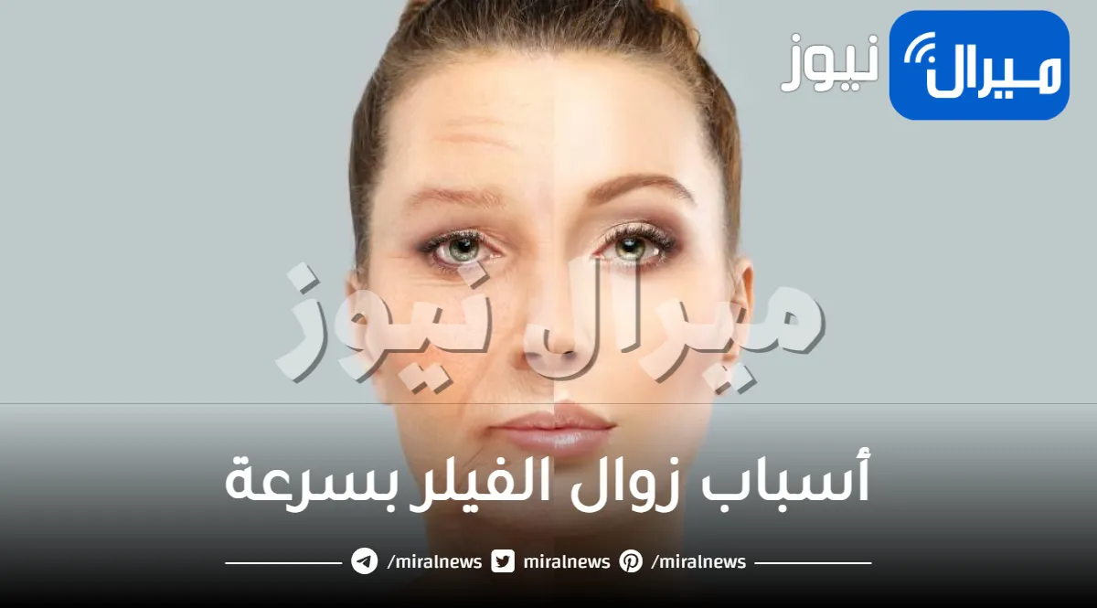 أسباب زوال الفيلر بسرعة