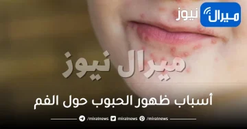 أسباب ظهور الحبوب حول الفم وطرق علاجها