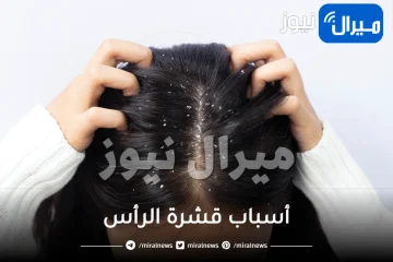 أسباب قشرة الرأس ومضاعفاتها ونصائح لتجنبها